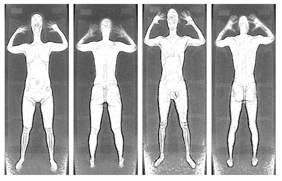 Full-body scanners used for local inmates may be flawed